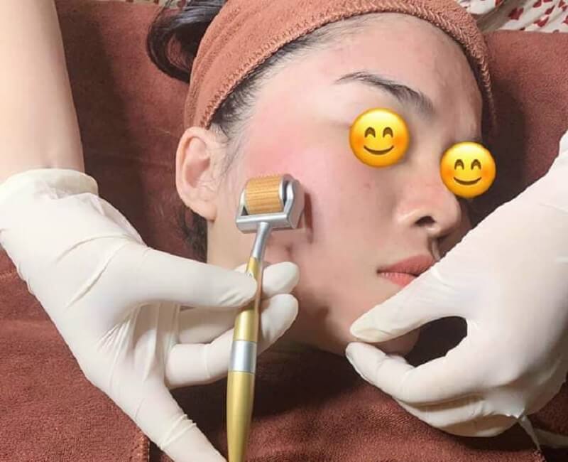 Đánh giá top 8 thẩm mỹ viện uy tín nhất ở Bến Tre 17 tham my vien o ben tre 12