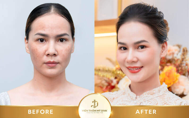Viện thẩm mỹ DIVA